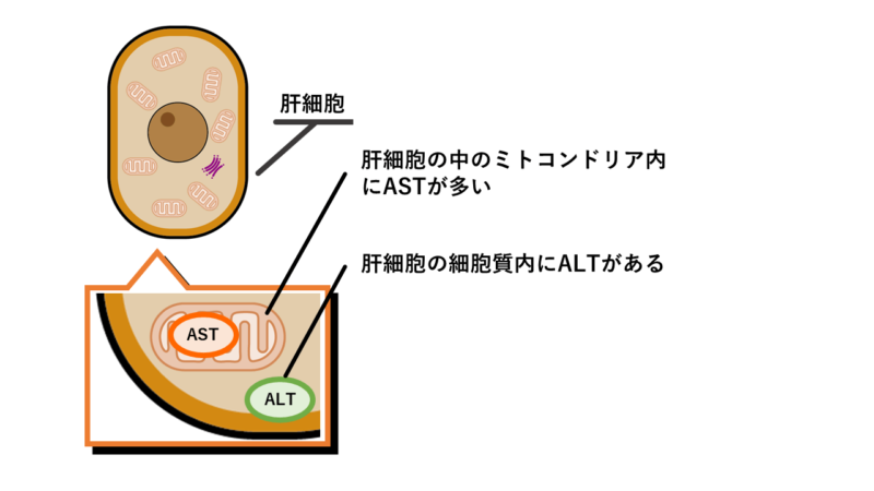 ALTは肝細胞の細胞質内に、ASTはミトコンドリア内に存在する