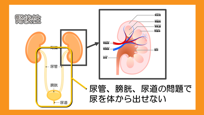腎後性とは尿管、膀胱、尿道の問題で尿を体から出せないこと